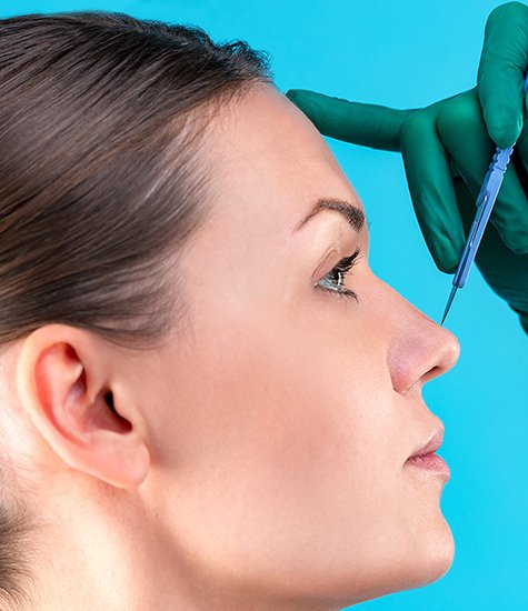 NON-SURGICAL-NOSE-FILLERS-LONDON