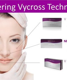 Why Rupesh uses Juvederm Vycross & not Juvederm Ultra in his clinic.
